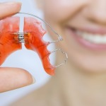 Ortodonzia Intercettiva per bambini